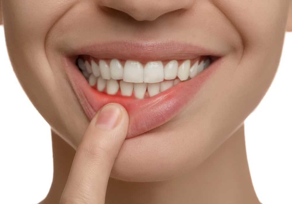 Diş Eti Hastalıkları Nelerdir, Nasıl Önlenir?