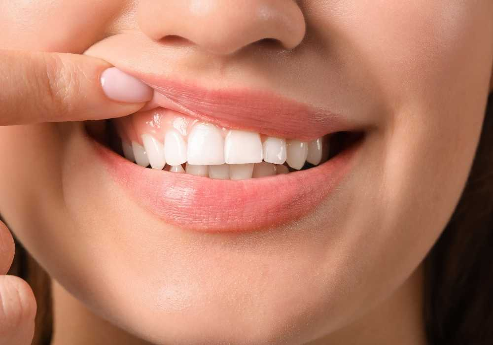 Diş Minesi Güçlendirme Yöntemleri Nelerdir?